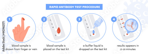 Covid-19 Rapid Antibody test procedure Infographic. Test kit with Patient blood sample. Buffer liquid on testing strip. Result for Coronavirus with antibody symbol. Vector illustration.