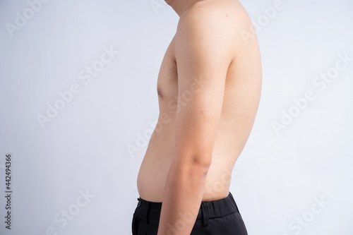 Cropped image of an Asian man with a hunchback