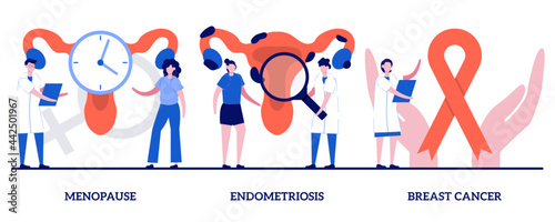 Menopause, endometriosis, breast cancer concept with tiny people. Gynecology, healthcare, female disease diagnosis abstract vector illustration set. Hormone disbalance, estrogen lack metaphor