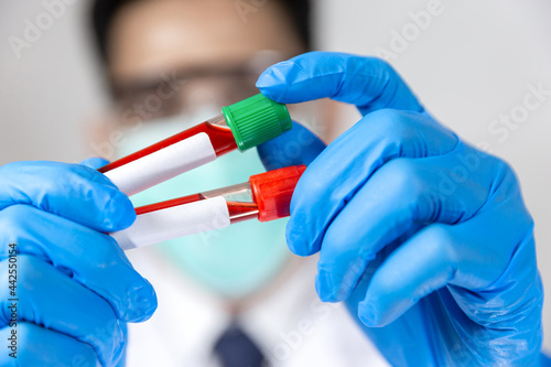 Doctor holding virus blood test tube