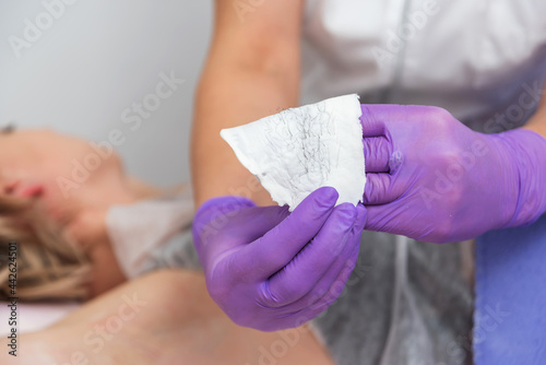 Hand with purple gloves are holding used wax stripes with removed hair. Depilation skin in spa salon