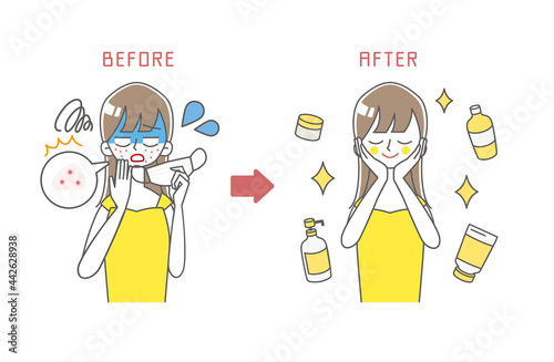 肌荒れに困る女性のBEFORE/AFTERイラスト