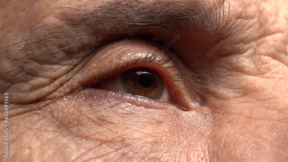 One Eye of the Elderly Man Looks to the Side. Wrinkles on the Skin. Lived a Long Life. One Eye of the Elderly Man Looks to the Side. Wrinkles on the Skin. Lived a Long Life.