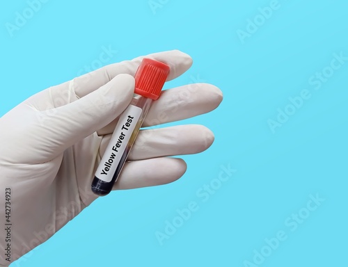 Biochemist or Lab Technologist holds Blood samples for yellow fever test in the blue background. photo