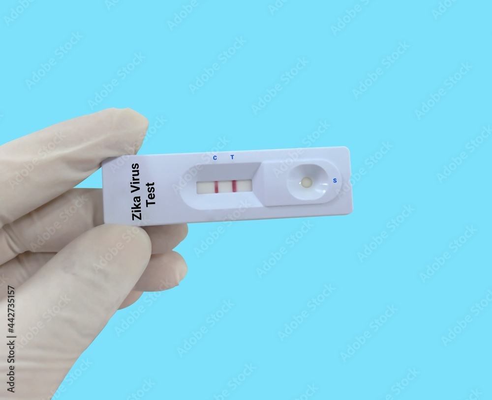 Biochemist or Lab Technologist holds a device of Avian Flu rapid screening test, showing a positive result