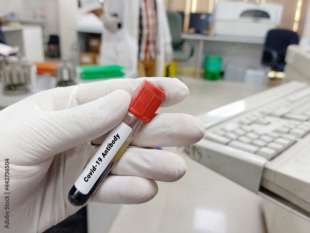 Biochemist or Lab Technologist holds Blood samples for Covid-19 antibody test in the laboratory. Biochemistry lab Close view. IgG, IgM test of Covid-19. Biochemist or Lab Technologist holds Blood samples for Covid-19 antibody test in the laboratory. Biochemistry lab Close view. IgG, IgM test of Covid-19.