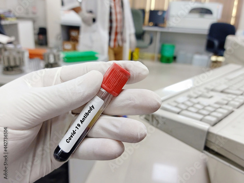 Biochemist or Lab Technologist holds Blood samples for Covid-19 antibody test in the laboratory. Biochemistry lab Close view. IgG  IgM test of Covid-19.