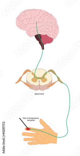 Pain Pathway. Nociception.  Ascending pathway that connect the periphery with the brain during pain and temperature sensation. Hand, spinal cord and brain. 
