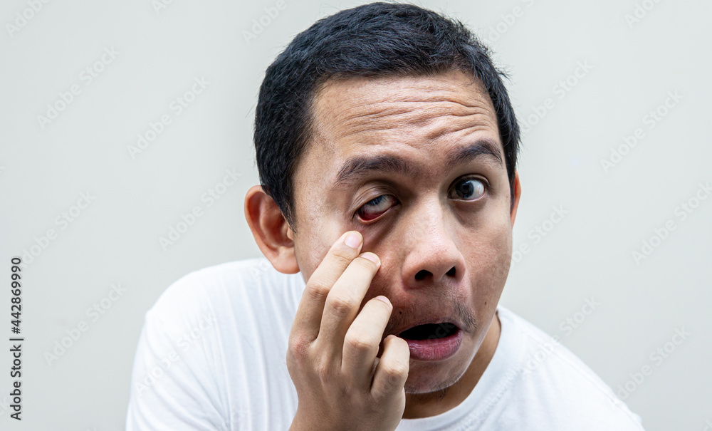 A portrait of young Asian Malay man checking his eyes condition in the morning by looking at the mirror in the bathroom on isolated white backgrounds. A portrait of young Asian Malay man checking his eyes condition in the morning by looking at the mirror in the bathroom on isolated white backgrounds.