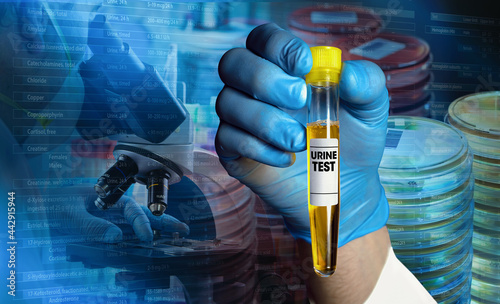 doctor holding urine tube test in laboratory for analysis in urine chemistry. biochemist with pee tube for urinalysis in the lab and background microscopist working with samples at microscope photo