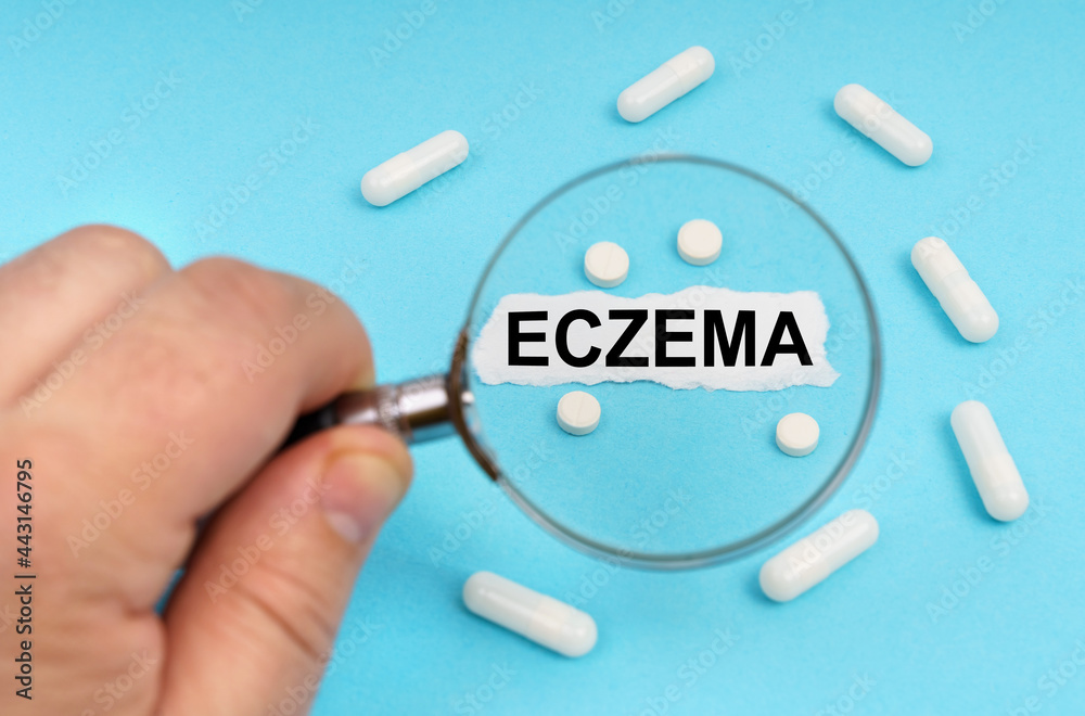 A man looks through a magnifying glass at pills and a leaf with the inscription - ECZEMA A man looks through a magnifying glass at pills and a leaf with the inscription - ECZEMA