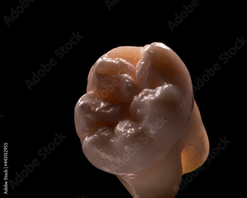 Molar tooth cuspid six