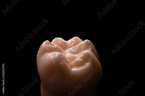Molar with six cuspid