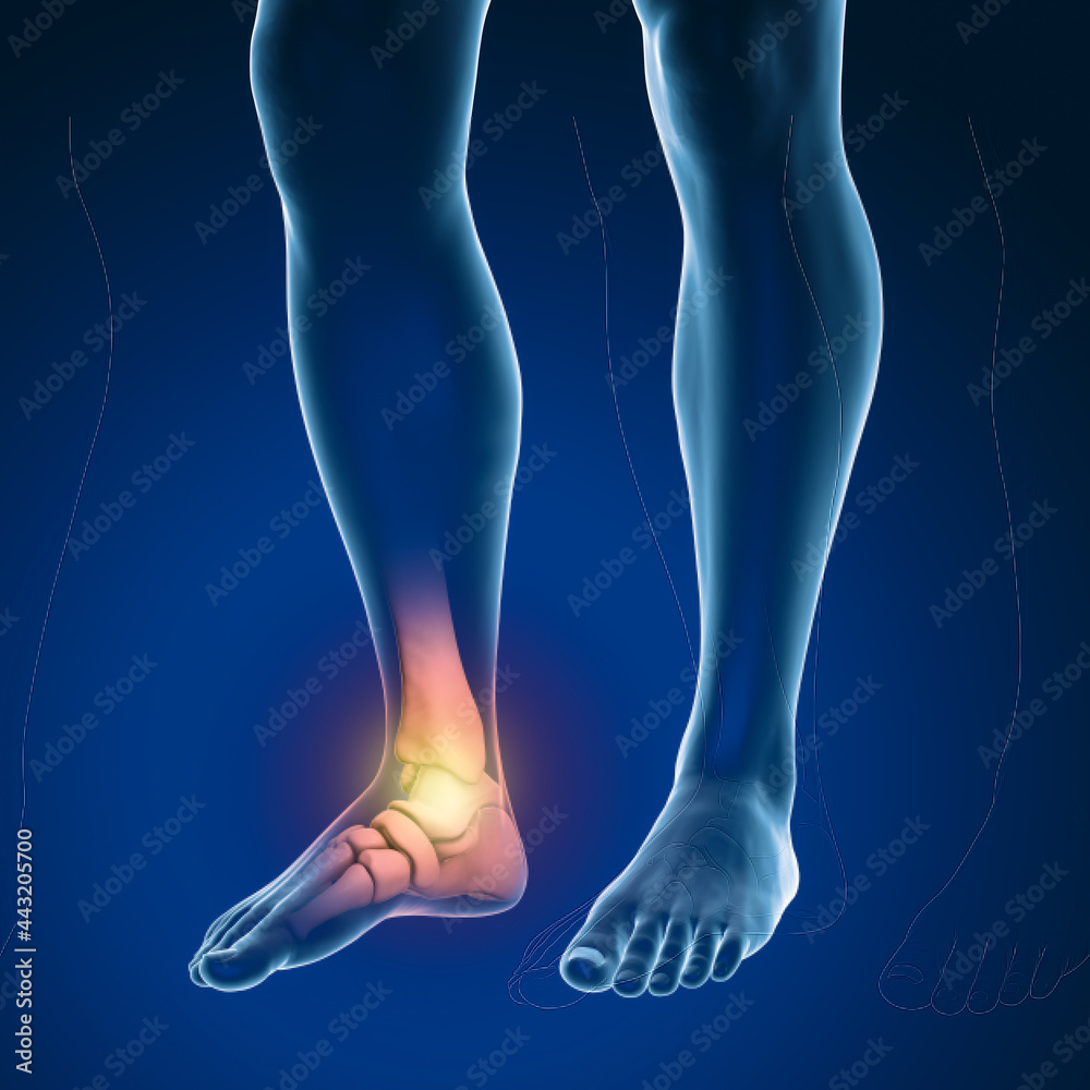 Foot and ankle pain, conceptual 3D illustration Foot and ankle pain, conceptual 3D illustration