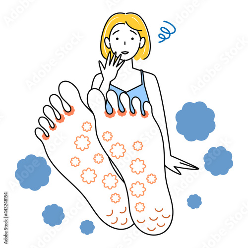 スキンケア 足が水虫になってしまい悲しんでいる可愛い女性 足裏のアップ イラスト ベクター