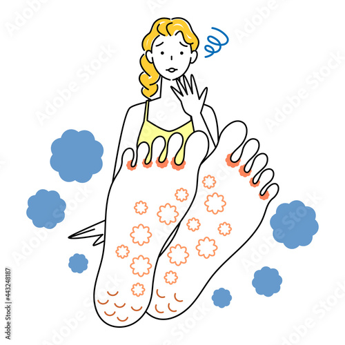 スキンケア 足が水虫になってしまい悲しんでいる可愛い女性 足裏のアップ イラスト ベクター