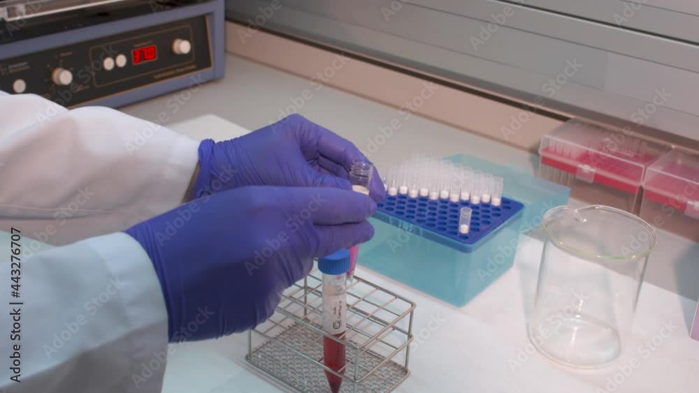 Laboratorio. Pipeteo 1