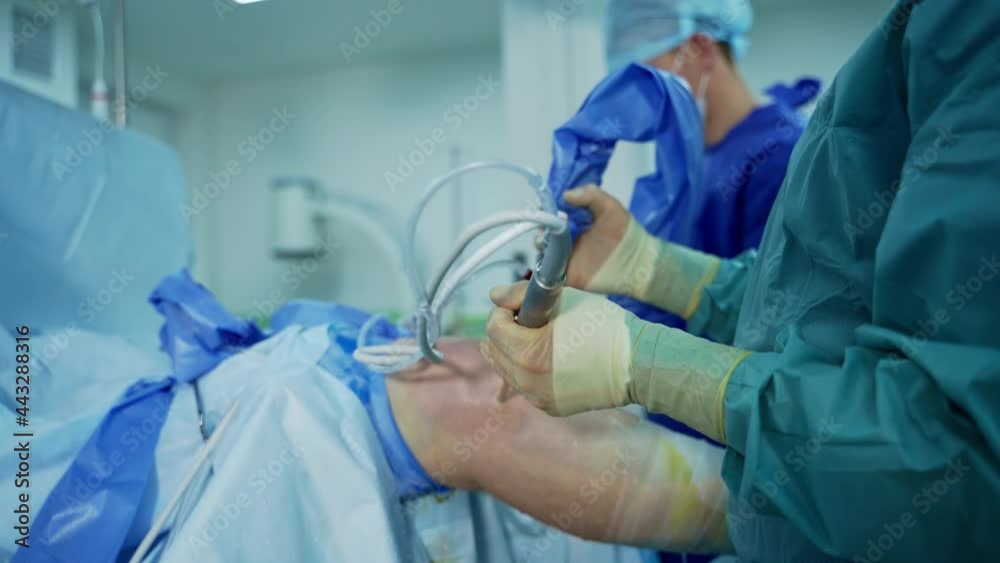 Process of trauma surgery operation. Group of surgeons in operating room with surgery equipment. Process of trauma surgery operation. Group of surgeons in operating room with surgery equipment.