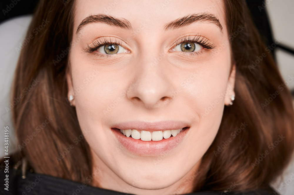 Close-up, cropped snapshot of beautiful woman's face with perfect smile. At dentist appointment. Teeth whitening. Top view. Healthy teeth concept Close-up, cropped snapshot of beautiful woman's face with perfect smile. At dentist appointment. Teeth whitening. Top view. Healthy teeth concept