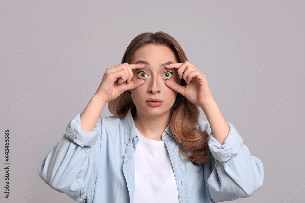 Woman with yellow eyes on grey background. Liver problems symptom Woman with yellow eyes on grey background. Liver problems symptom