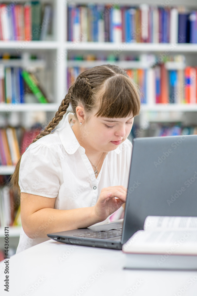 Clever girl with syndrome down uses a laptop at library. Education for disabled children concept Clever girl with syndrome down uses a laptop at library. Education for disabled children concept