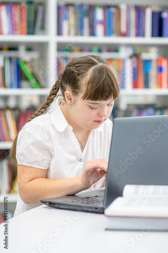 Clever girl with syndrome down uses a laptop at library. Education for disabled children concept