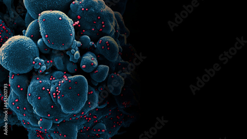 Photos Novel Coronavirus SARS-CoV-2 electron micrograph