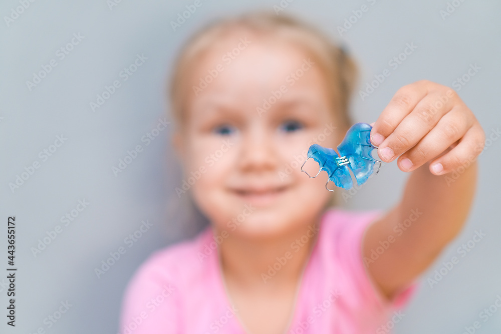 Dental plate. Expansion of the jaw in a child. A plate to heaven. There is not enough room for the molars. Dental plate. Expansion of the jaw in a child. A plate to heaven. There is not enough room for the molars.
