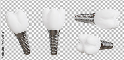 3d render of dental implant collection on transparent background,with clipping path photo