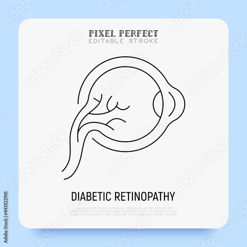 Diabetic retinopathy thin line icon. Ophthalmology. Damage of eyeball because of diabetes mellitus disease. Pixel perfect, editable stroke. Vector illustration.