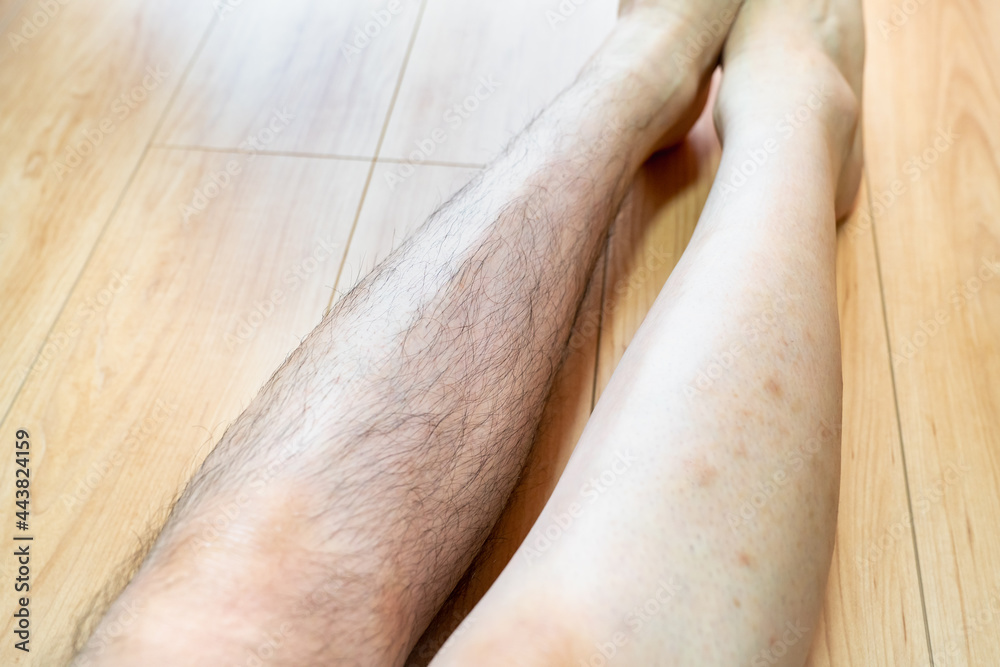 Naklejka premium 足の毛を剃った男性の写真。剃る前と剃った後の写真。
