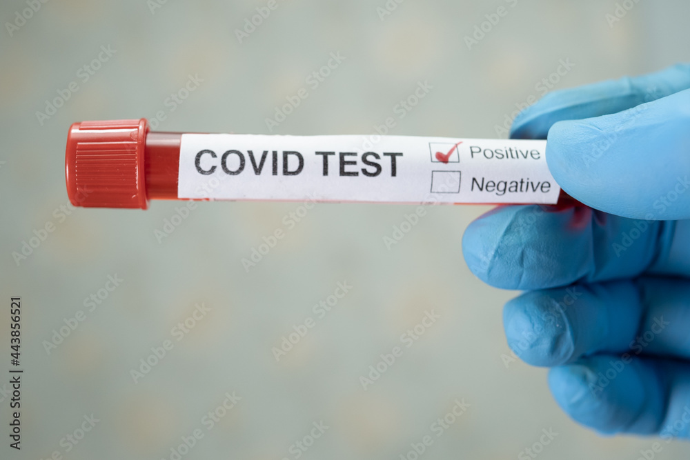 Obraz premium Positive blood infection sample in test tube for covid-19 coronavirus in lab. Scientist holding to check and analyze for patient in hospital.