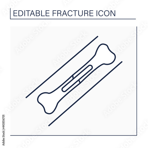 Metal plates line icon. Implanted metal can help broken bones heal in proper alignment.Treatment. Healthcare concept. Isolated vector illustration. Editable stroke