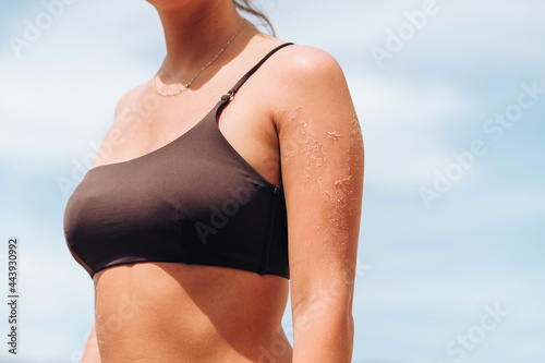 Damaged peeling skin
