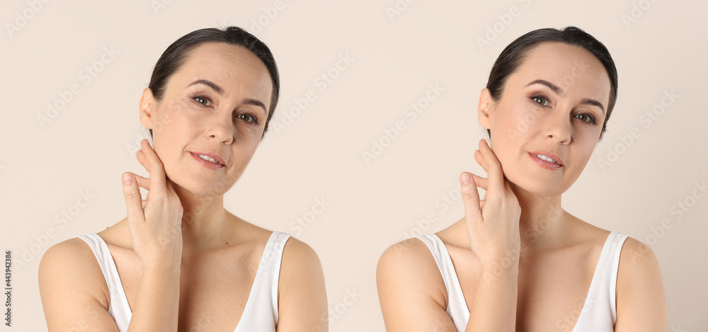 Photo before and after retouch, collage. Portrait of beautiful mature woman on beige background, banner design Photo before and after retouch, collage. Portrait of beautiful mature woman on beige background, banner design