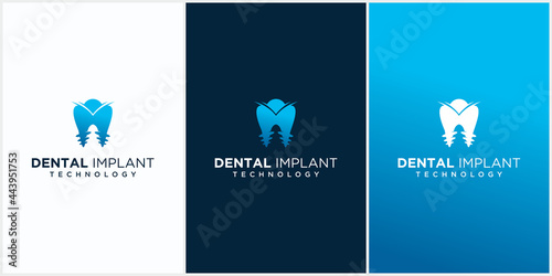 Dental implant clinic technology logo design dental implant logo vector with business card