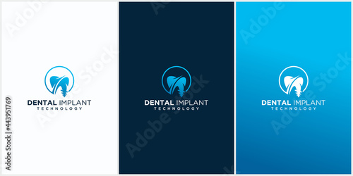 Dental implant clinic technology logo design dental implant logo vector with business card