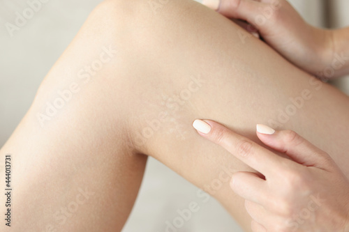 Light scar on skin on woman leg closeup photo