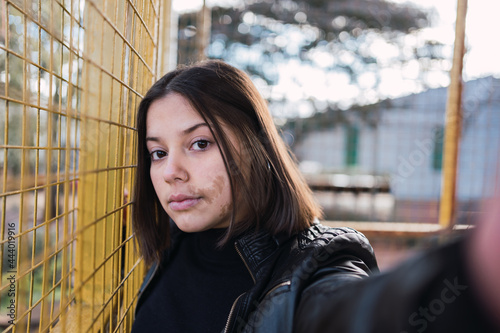 Portrait of a young woman with moles on her face.