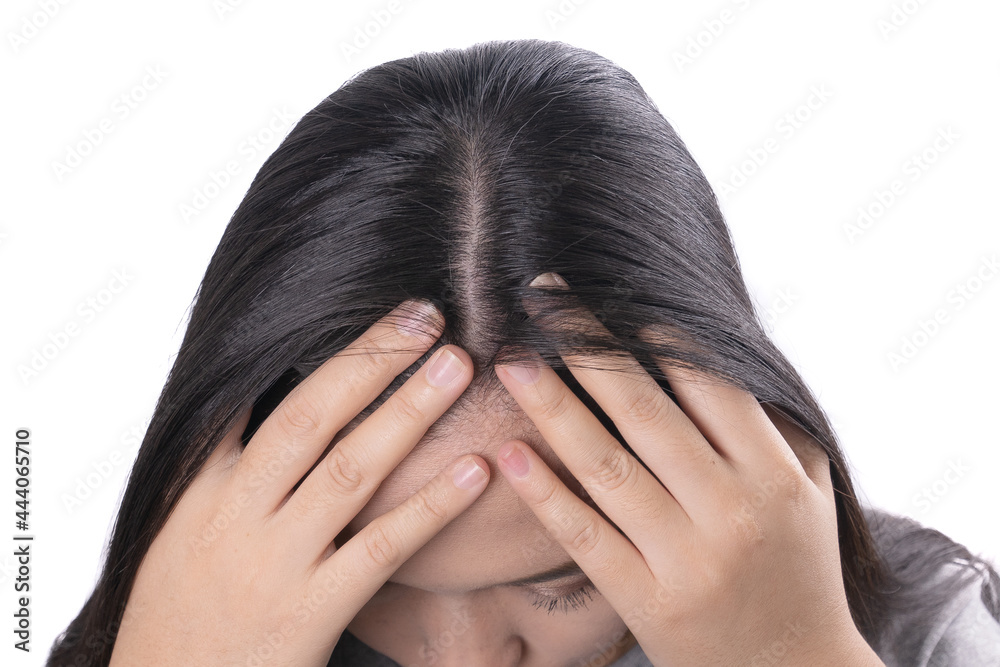 Fototapeta premium Young Asian women worry about problem hair loss,head bald,dandruff.hair loss problem and Hair treatment concept