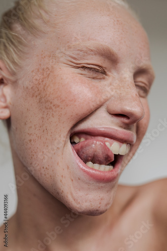Young freckled girl