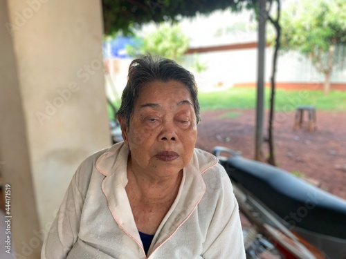 An elderly woman with one closed eye is resting outside the house, blurry background.