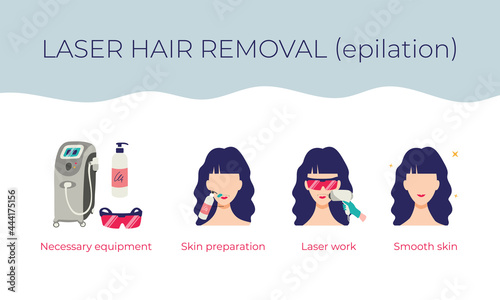 Laser hair removal on the face. Stages of the procedure. Vector illustration of a young woman in cartoon style