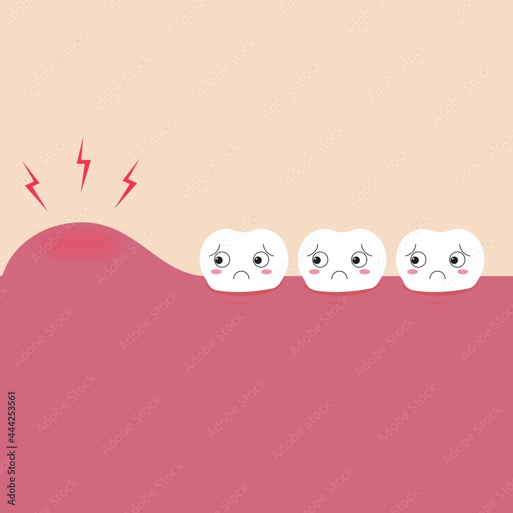 Swollen gum flat illustration vector