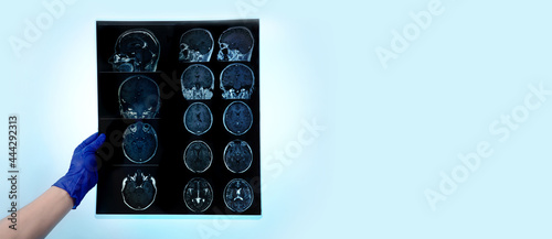 hand in glove holds MRI brain scan or magnetic resonance image results, neurology concept, snapshot over blue background, panoramic layout © alesmunt