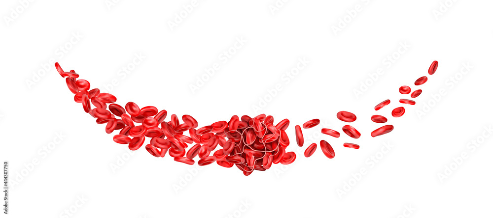 A blood clot without a vein stops the flow of red blood cells. 3d vector illustration