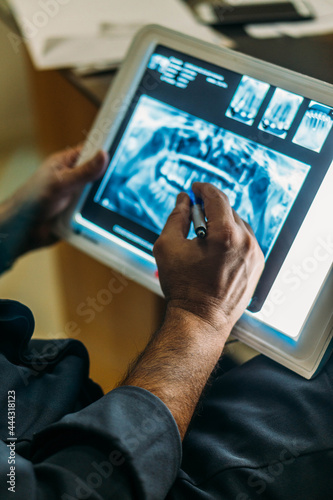 dentist using digital tablet x-ray