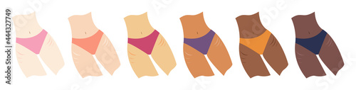 Female bodies with stretchmarks in tights. Women of with different shades of skin color in underwear with striae on legs. Body positivity, beauty, skincare concepts photo