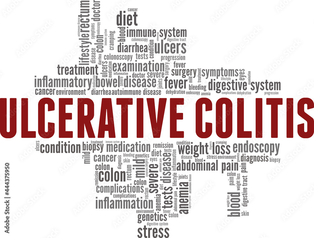 Ulcerative Colitis vector illustration word cloud isolated on a white background. Ulcerative Colitis vector illustration word cloud isolated on a white background.