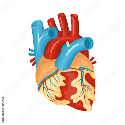 Diseased Heart Illustration